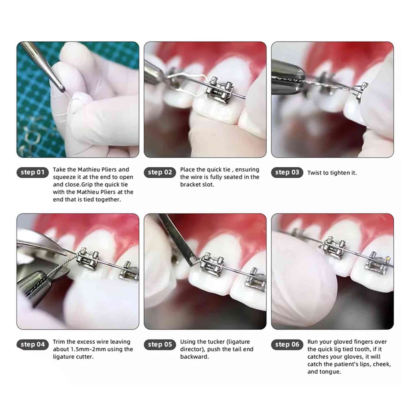 Lace Back Wire (Ligature Wire) - Pack Of 50