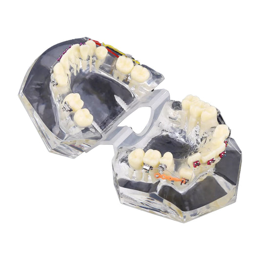 Orthodontic Study Teeth Model