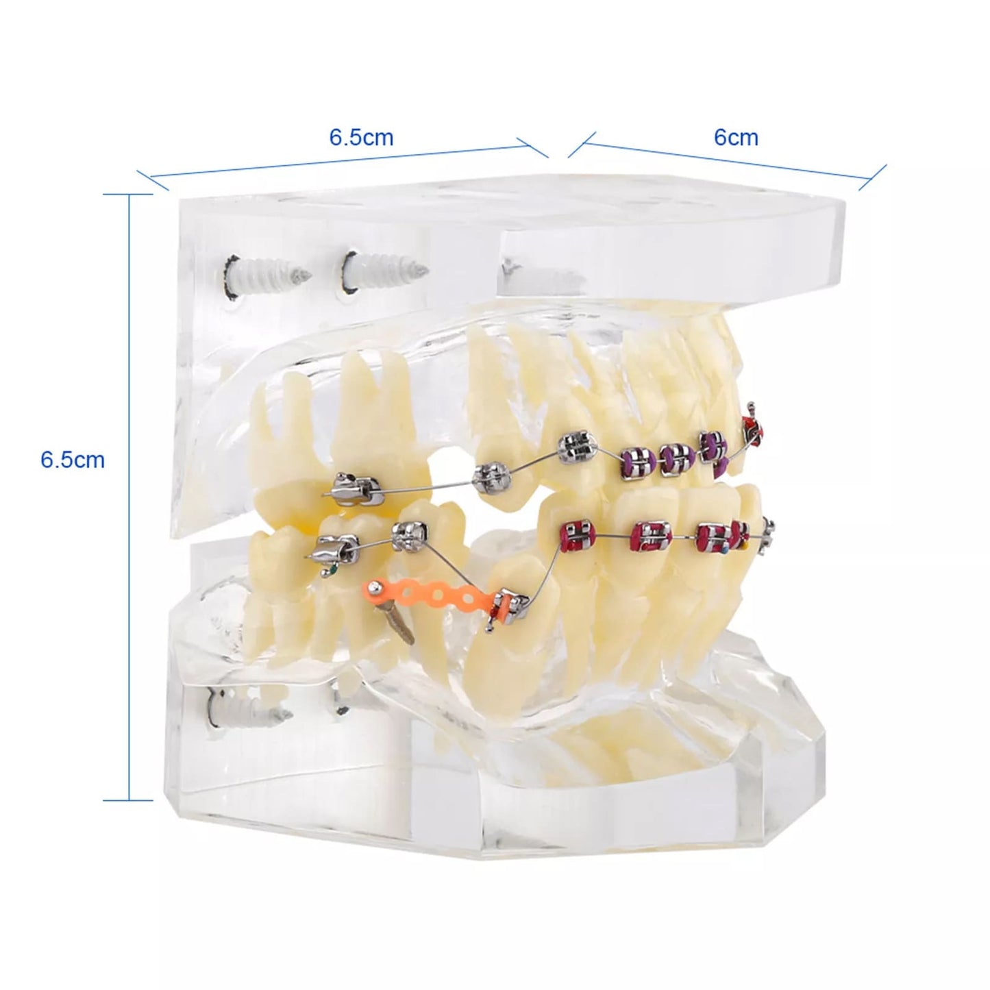 Orthodontic Study Teeth Model