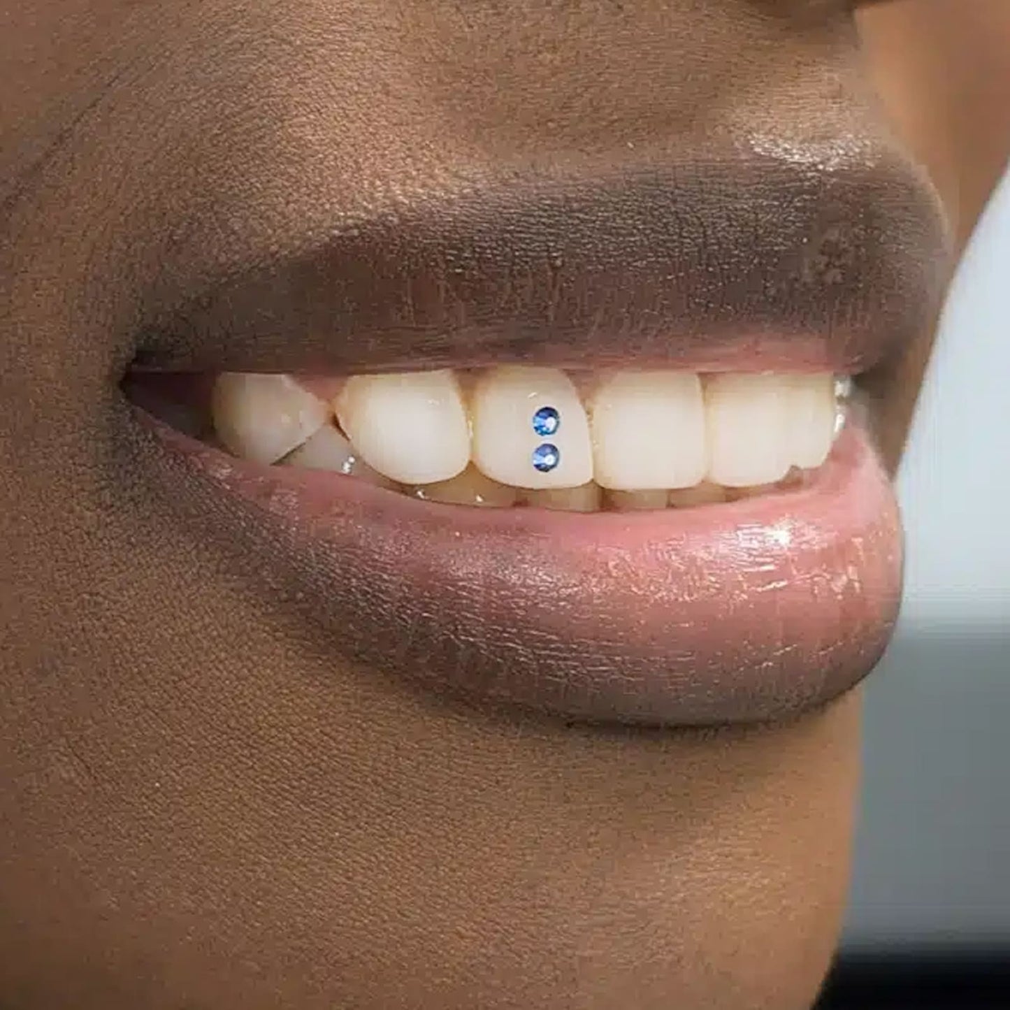 Teeth Decoration Dental Crystal