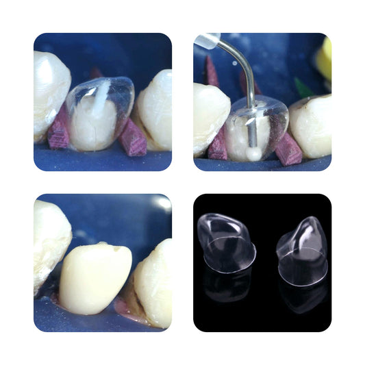 Preformed Temporary Transparent Crowns For Kids