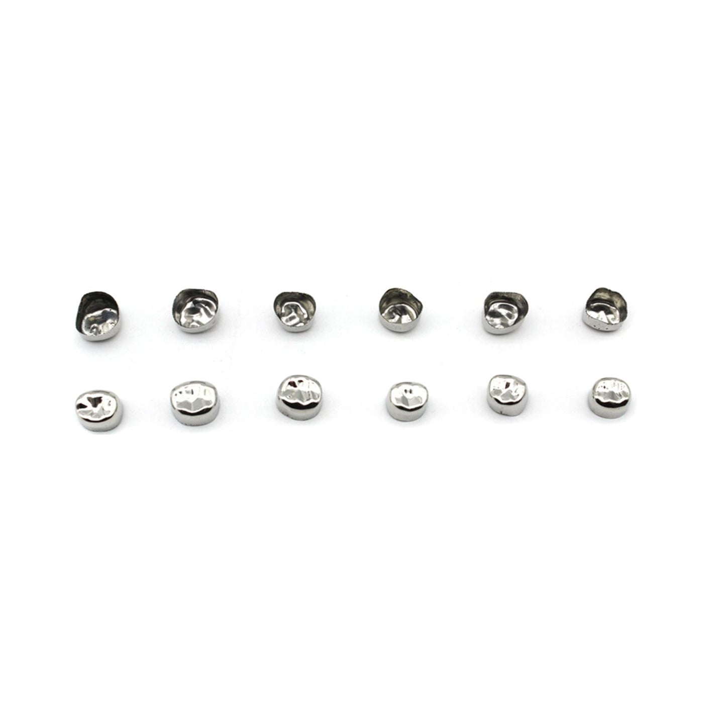 Preformed Temporary Stainless Steel Crowns For Kids