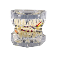 Orthodontic Study Teeth Model