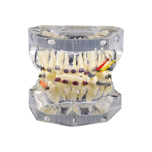 Orthodontic Study Teeth Model