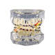 Orthodontic Study Teeth Model