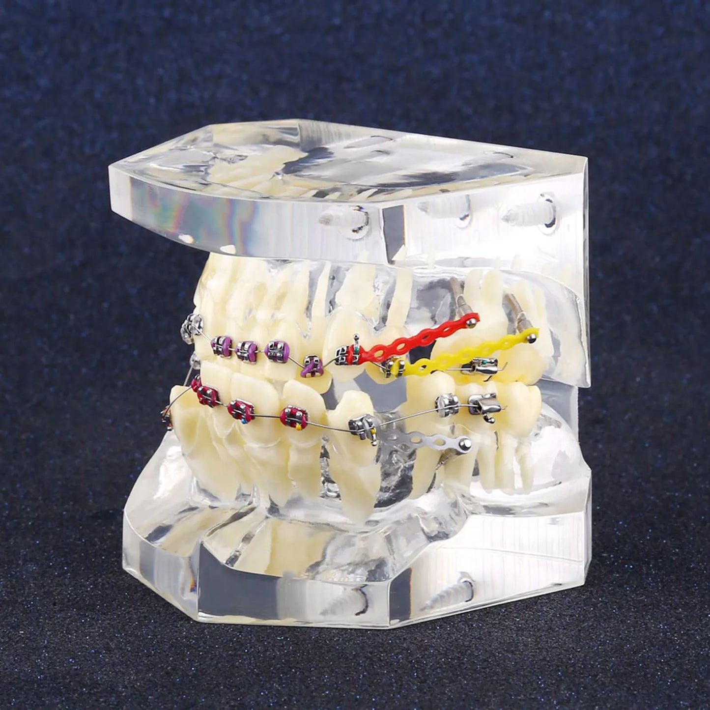 Orthodontic Study Teeth Model