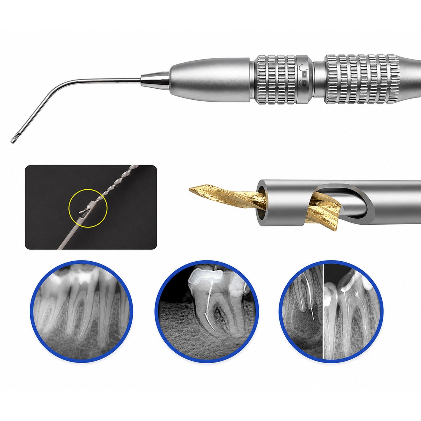 Root Canal File Removal Kit