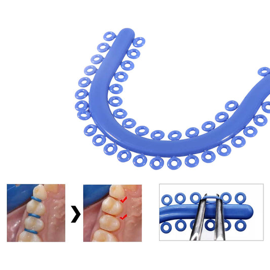 Elastic Separators